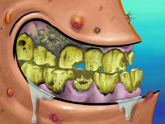 ugly real British teeth
