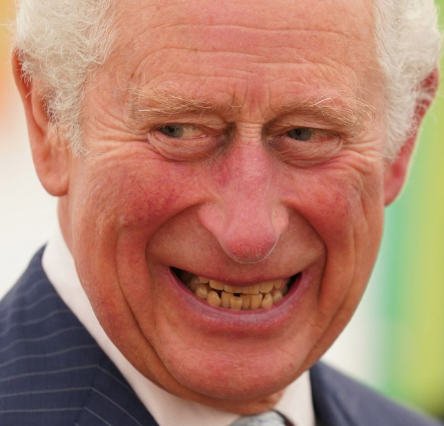 ugly real British teeth